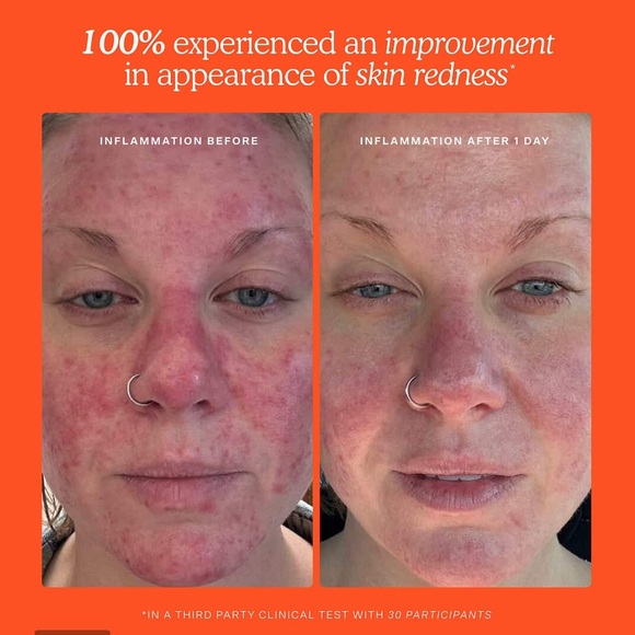 Tower 28 Skin Rescue Solution Mini Size - Picture 3 of 4